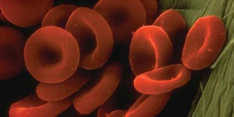 Γονιδιακή θεραπεία πετυχαίνει ίαση της μεσογειακής αναιμίας