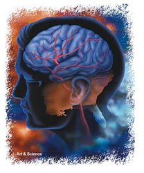 Πειραματικό φάρμακο μειώνει την βλάβη που προκαλεί το εγκεφαλικό επεισόδιο