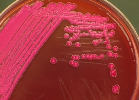 Σε όλο τον κόσμο εξαπλώνεται η νέα κατηγορία πολυανθεκτικών βακτηρίων