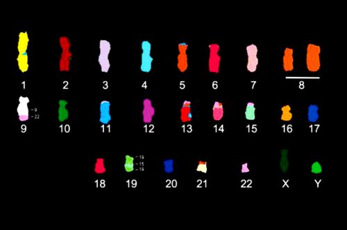 Κοινό το γενετικό υπόβαθρο για τους καρκίνους του μαστού και των ωοθηκών