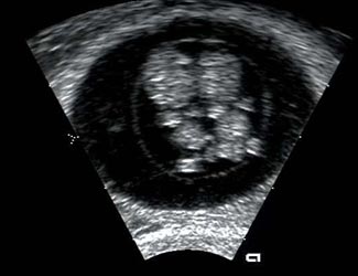 Η κοινωνικότητα του ανθρώπου ξεκινά από εμβρυϊκό στάδιο