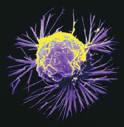 Βιο-δείκτης ευρέως φάσματος υπόσχεται ενιαία αντιμετώπιση του καρκίνου