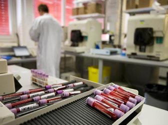 Τον ρόλο της ομάδας αίματος στην γυναικεία γονιμότητα εξετάζουν οι επιστήμονες