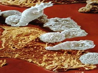 Ελπίδες για νέας γενιάς αντι-ιικά φάρμακα, από μελέτη για το ανοσοποιητικό σύστημα