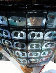 Σταθερός ο αριθμός νέων κρουσμάτων της φυματίωσης, σύμφωνα με έκθεση του ΠΟΥ