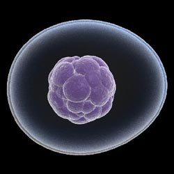 Ολοκληρώθηκε η πρώτη θεραπεία εγκεφαλικού επεισοδίου με βλαστοκύτταρα