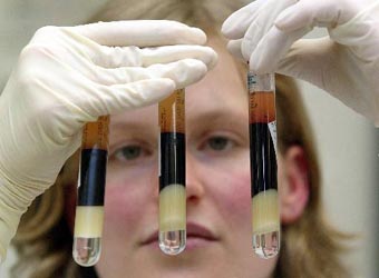 Αιματολογική εξέταση προσδιορίζει την ηλικία του ανθρώπου