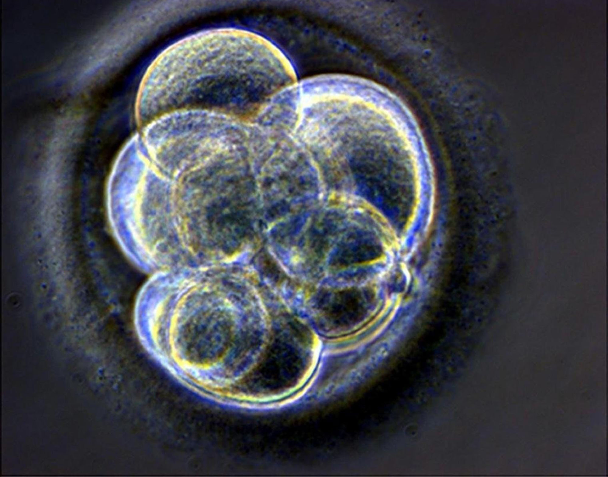 Δεύτερη αμερικανική δοκιμή με εμβρυακά βλαστοκύτταρα, αυτή τη φορά για την τύφλωση