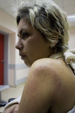 «Θύμα ξυλοδαρμού» η Ιρανή δημοσιογράφος απεργός πείνας, καταγγέλλουν ακτιβιστές