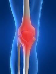 Αντικατάσταση των αρθροπλαστικών με αναγέννηση αρθρικών χόνδρων, προβλέπουν οι επιστήμονες