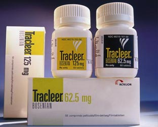 Βελτιωμένη αντιμετώπιση του σκληροδέρματος με μποσεντάνη