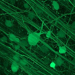 Ανακαλύφθηκε νέο είδος κυττάρου που εμπλέκεται στην όραση