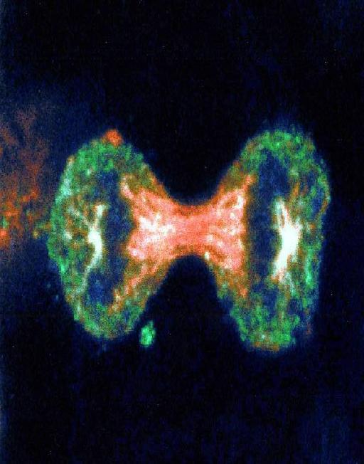 Πώς μεταδίδεται η ασθένεια αυτή;