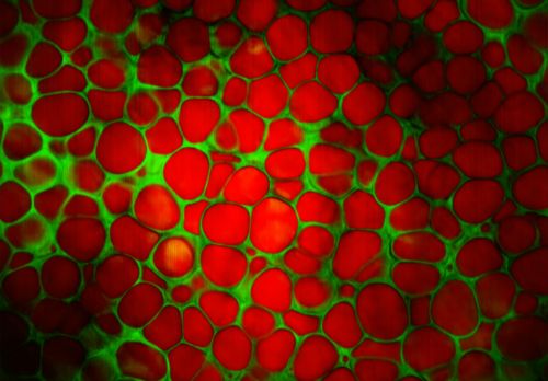 Μικροσκόπιο νέας τεχνολογίας βιντεοσκοπεί ζωντανά δείγματα