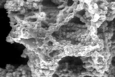 Νέο είδος βακτηρίου βρέθηκε να κατατρώει το ναυάγιο του Τιτανικού