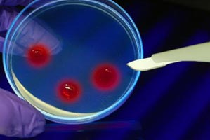 Διαγνωστικό τεστ εντοπίσει γενετικές μεταλλάξεις στο γονιδίωμα των γονέων