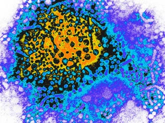 Χρόνια ηπατίτιδα Β και C: Οι «κρυφές επιδημίες»