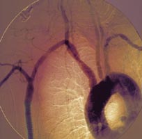 Λειτουργικά αιμοφόρα αγγεία σε εργαστηριακό περιβάλλον, δημιούργησαν Αμερικανοί ερευνητές