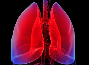 Η φαρμακευτική αγωγή βελτιώνει τη επιβίωση των πασχόντων από πνευμονική αρτηριακή υπέρταση