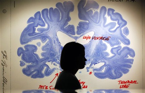 Γονίδιο φαίνεται να προδιαθέτει για κατάθλιψη με διαφορετικό μηχανισμό