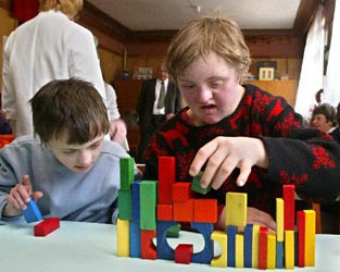 Αιματολογική εξέταση προβλέπει εγκαίρως το σύνδρομο Down