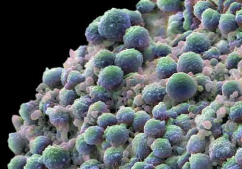 Τεστ DNA για την ανίχνευση καρκίνου στο παχύ έντερο αναπτύσσουν Βρετανοί επιστήμονες