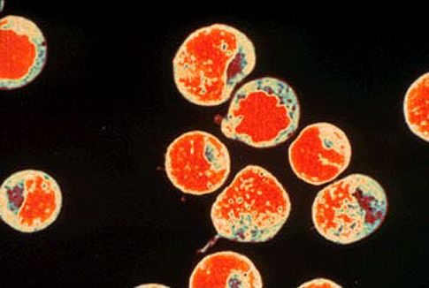 Πειραματική γονιδιακή θεραπεία, νέα προσέγγιση κατά του HIV