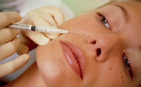 Ρυτίδες – Θεραπεία με ενέσεις κολλαγόνου