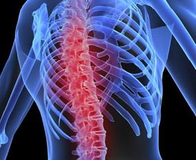 Μείωση των οστεοπορωτικών καταγμάτων υπόσχεται το ρανελικό στρόντιο