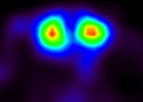 Τομογράφος-μινιατούρα εξετάζει πειραματόζωα ενώ κινούνται