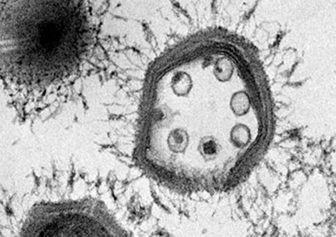 Ιοί που τρώνε ιούς μπορεί να παίζουν σημαντικό ρόλο στο περιβάλλον