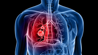Ειδικές μορφές άσθματος