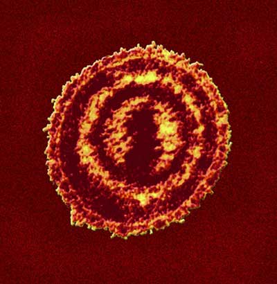 Ανεμευλογιά