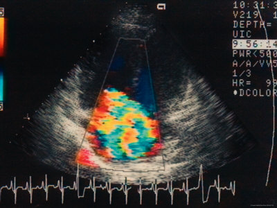 Εξετάσεις για τη στεφανιαία νόσο
