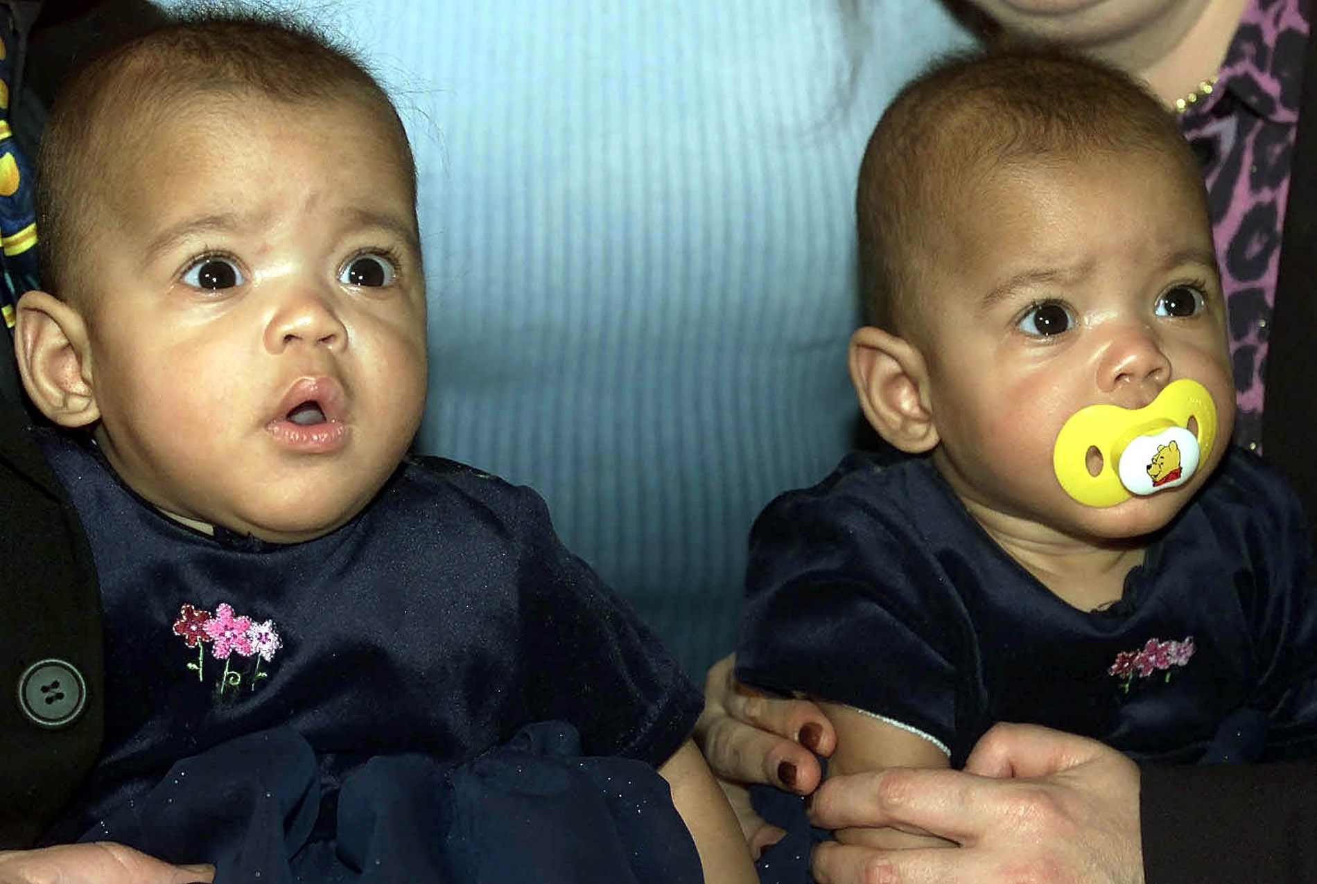 Τα κορίτσια με δίδυμο αδερφό ίσως είναι υπέρβαρα