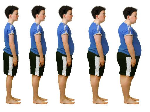 «Όλοι οι τύποι παχυσαρκίας είναι εξίσου κακοί», υποστηρίζει διεθνής ερευνητική ομάδα