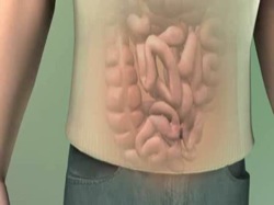 Πρωτοποριακή μέθοδος θεραπείας της ακράτειας κοπράνων