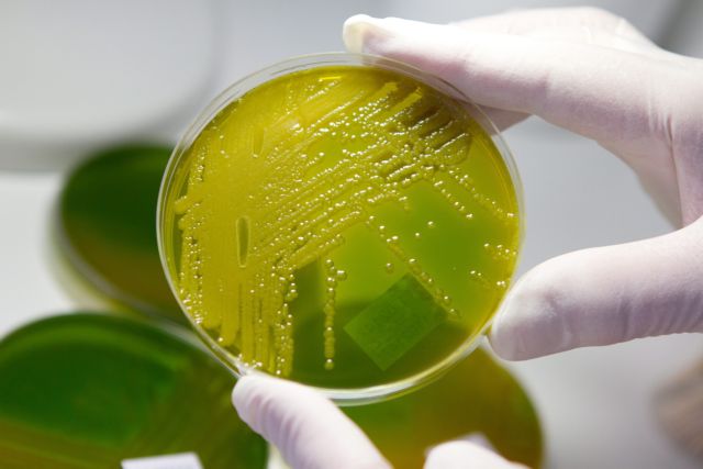 Τι είναι και πώς μεταδίδεται η εντεροαιμορραγική Escherichia coli