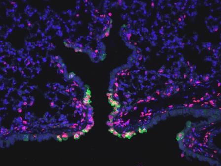 Εντοπίστηκαν πνευμονικά βλαστικά κύτταρα