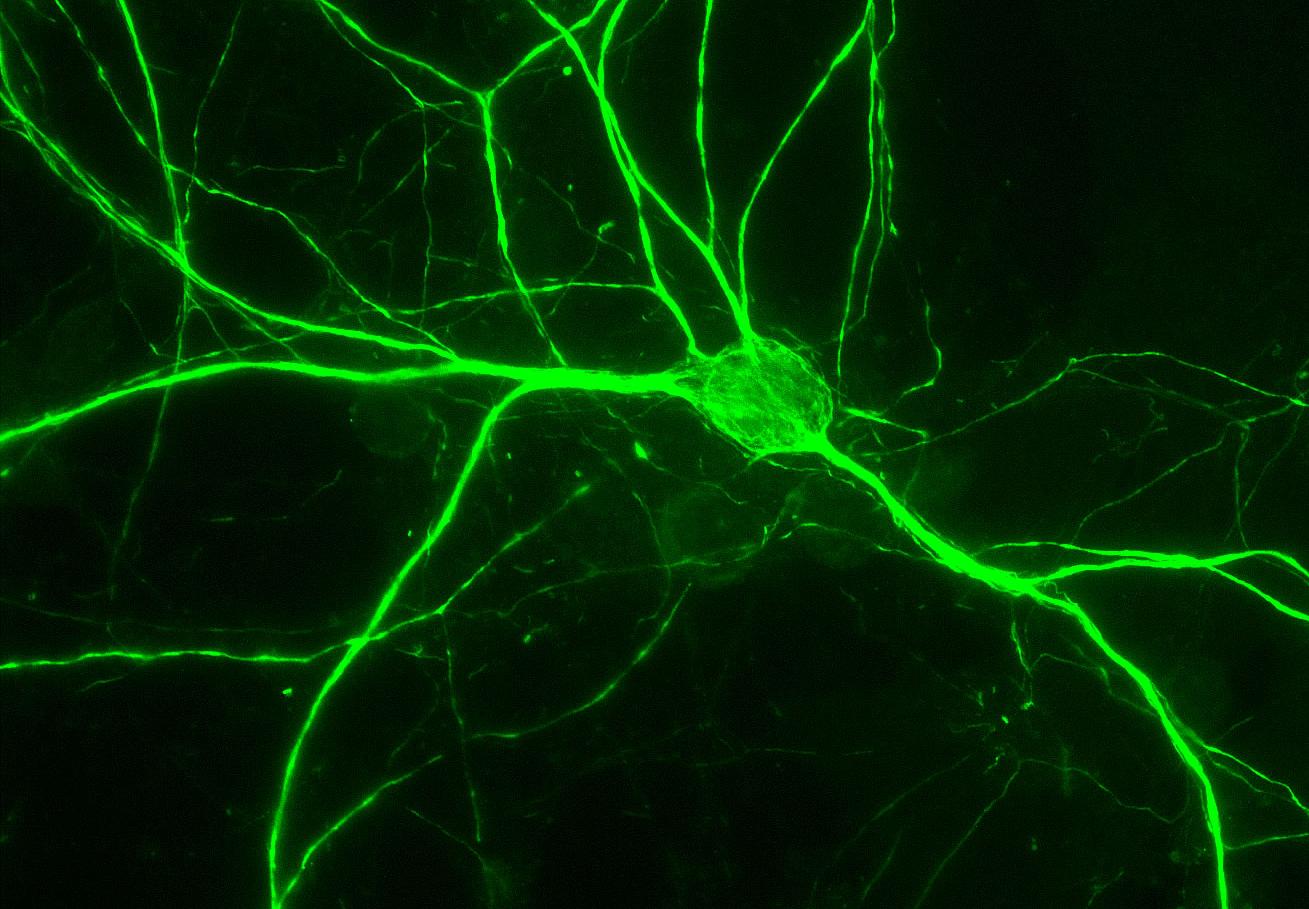 Κύτταρα δέρματος μετατρέπονται απευθείας σε νευρώνες