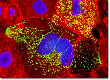 Νέα διαγνωστική μέθοδος υπόσχεται πρώιμο εντοπισμό της νόσου Αλτσχάιμερ