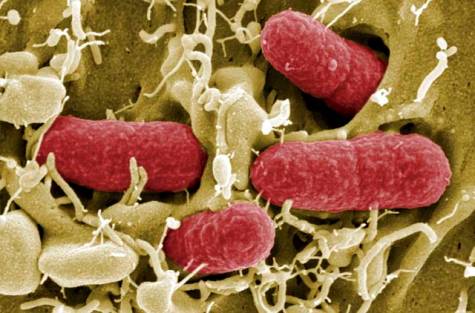 Σταθερή αλλά σοβαρή η κατάσταση της υγείας ενός εκ των παιδιών που έχουν προσβληθεί από E.coli