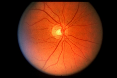 Πρωτεΐνη του αμφιβληστροειδή χιτώνα αντιλαμβάνεται τα μαγνητικά πεδία