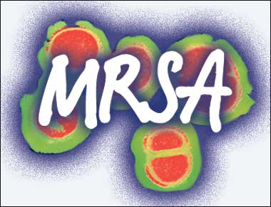 Εντοπίστηκε νέο στέλεχος του υπερανθεκτικού μικροβίου MRSA