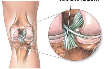 Λύση στο πρόβλημα της οστεοαρθρίτιδας θα δώσει η δημιουργία νανοαρθροχόνδρου