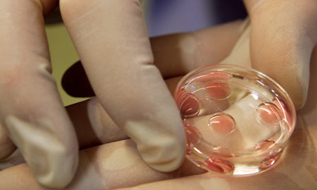 Κίνδυνο απόκτησης παιδιού με σύνδρομο Down συνεπάγεται η εξωσωματική γονιμοποίηση