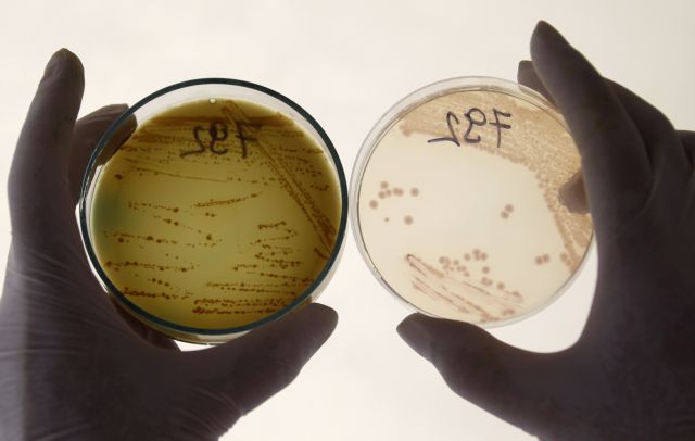 Νεκρή 78χρονη στη Γαλλία από το βακτήριο E.coli