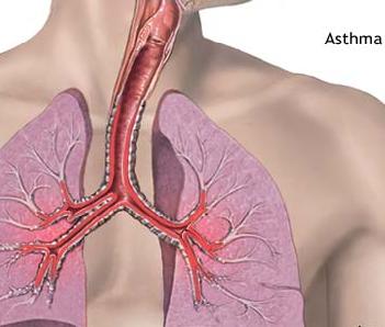 Ψυχολογικοί παράγοντες επιδρούν στον έλεγχο του άσθματος