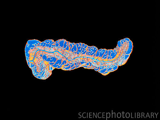 Πιο κοντά στην δημιουργία τεχνητού παγκρέατος, βρίσκονται οι επιστήμονες