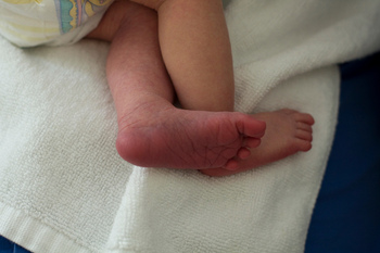 Απλή και γρήγορη εξέταση εντοπίζει συγγενή καρδιακά ελλείμματα στα νεογνά